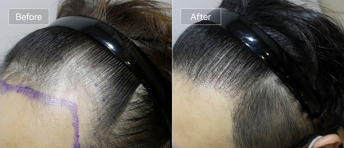 /filedata/md_board/20260102161445_04bZGurF_sub1_slide6.jpg 전후사진