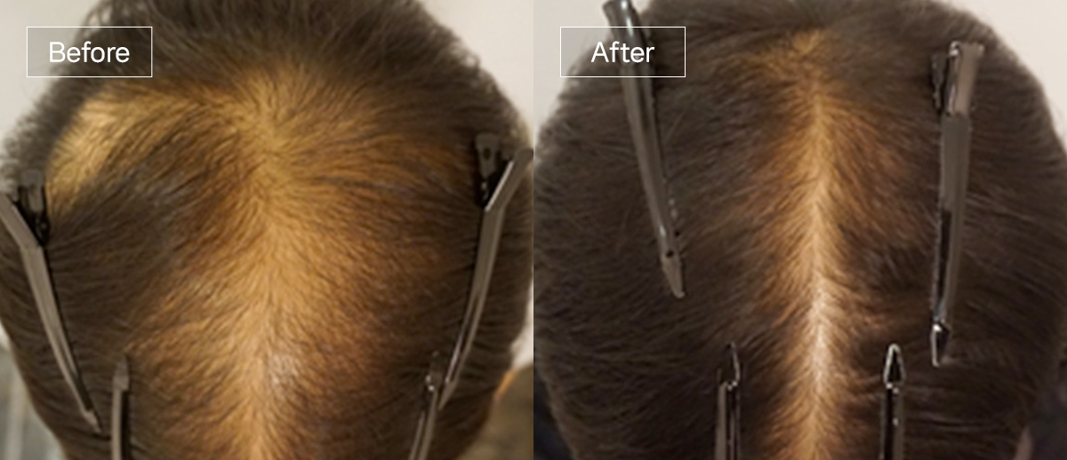 /filedata/md_board/20260102162220_OPALgrmG_sub4_slide2.jpg 전후사진