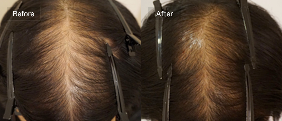 /filedata/md_board/20260102162251_uYyIEiqa_sub4_slide6.jpg 전후사진