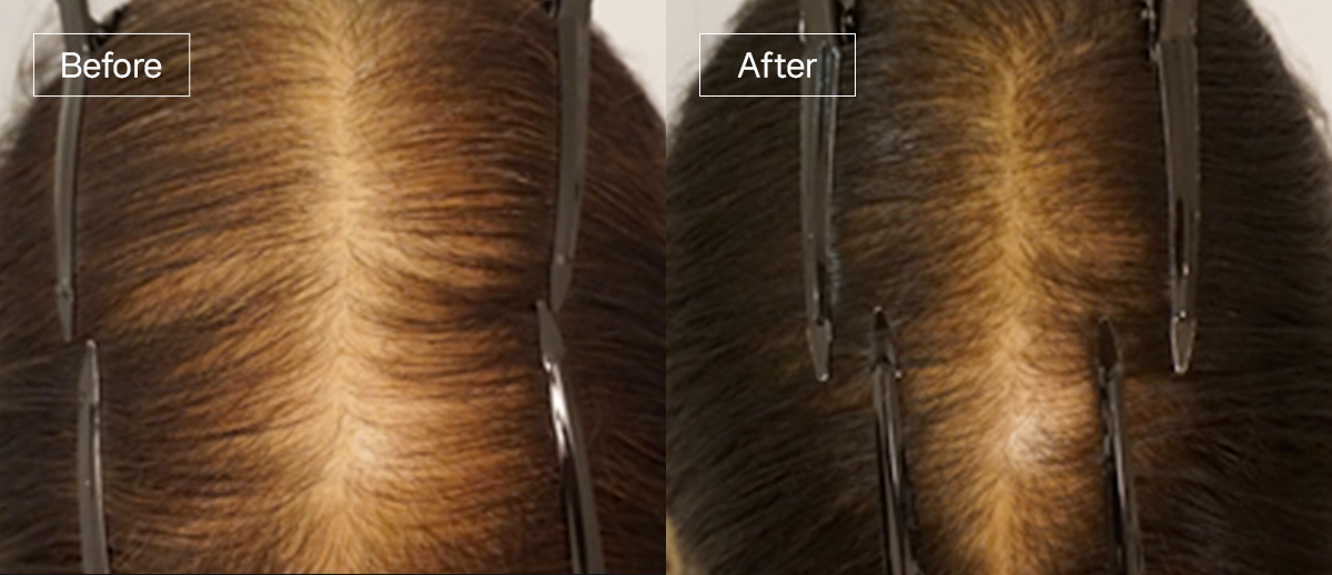 /filedata/md_board/20260102162257_3ZKtDo6d_sub4_slide7.jpg 전후사진