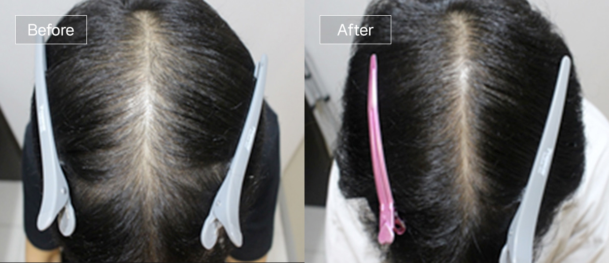 /filedata/md_board/20260102162303_kmEfhKbR_sub4_slide8.jpg 전후사진