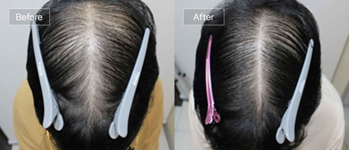 /filedata/md_board/20260102162309_PkNeFORs_sub4_slide9.jpg 전후사진