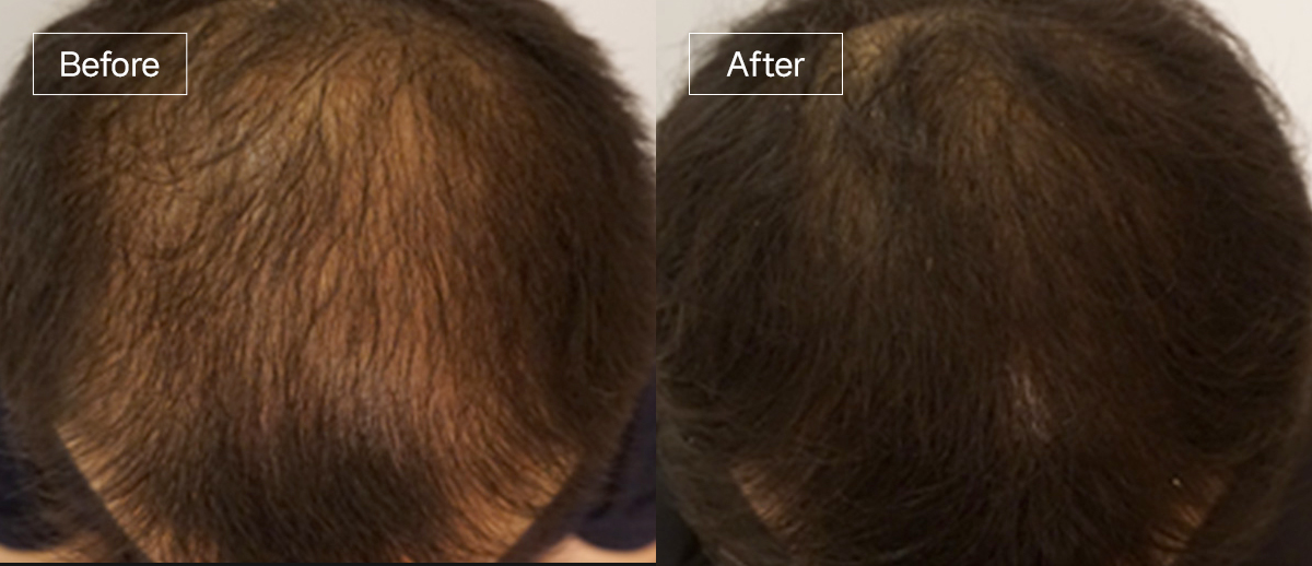 /filedata/md_board/20260102162315_60nj7yU4_sub4_slide10.jpg 전후사진