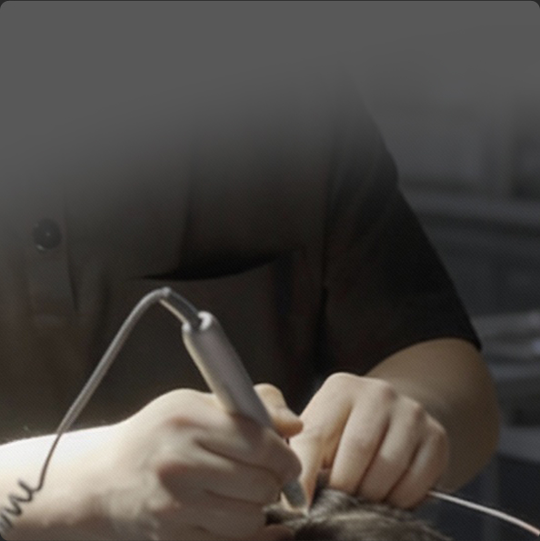 연세모벨르의원 SMP 두피문신