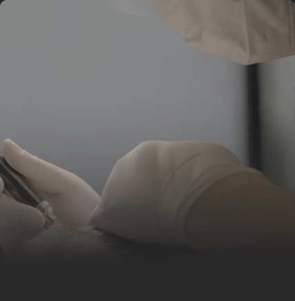 연세모벨르의원 SMP 두피문신